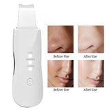 Derma Skin Scrubber Pen